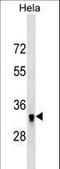 3-hydroxyisobutyrate dehydrogenase, mitochondrial antibody, LS-C159831, Lifespan Biosciences, Western Blot image 