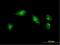 Mesenchyme Homeobox 1 antibody, H00004222-M03, Novus Biologicals, Immunocytochemistry image 