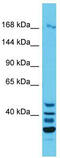 Glutamine And Serine Rich 1 antibody, TA330753, Origene, Western Blot image 