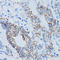 Galectin 8 antibody, STJ28729, St John