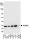 Proteasome Subunit Beta 4 antibody, A303-819A, Bethyl Labs, Western Blot image 