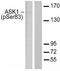 Mitogen-Activated Protein Kinase Kinase Kinase 5 antibody, AP20925PU-N, Origene, Western Blot image 