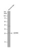 Glutathione S-Transferase Mu 1 antibody, NBP1-33523, Novus Biologicals, Western Blot image 