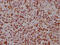 Fatty Acid Binding Protein 4 antibody, CSB-PA007945LA01HU, Cusabio, Immunohistochemistry frozen image 