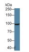 Microsomal Triglyceride Transfer Protein antibody, LS-C372995, Lifespan Biosciences, Western Blot image 