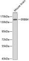 HER4 antibody, 13-274, ProSci, Western Blot image 