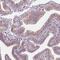 Dynein Regulatory Complex Subunit 3 antibody, PA5-57504, Invitrogen Antibodies, Immunohistochemistry frozen image 