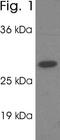 Proteasome Activator Subunit 1 antibody, PA1-960, Invitrogen Antibodies, Western Blot image 