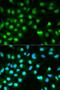 Protein Phosphatase 3 Catalytic Subunit Alpha antibody, LS-C331233, Lifespan Biosciences, Immunofluorescence image 