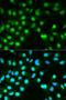 Serine/threonine-protein phosphatase 2B catalytic subunit alpha isoform antibody, LS-C331233, Lifespan Biosciences, Immunofluorescence image 