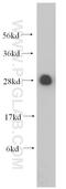 Ribosomal Protein L19 antibody, 14701-1-AP, Proteintech Group, Western Blot image 