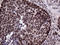 LIM Homeobox 4 antibody, LS-C792133, Lifespan Biosciences, Immunohistochemistry paraffin image 