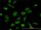 Nuclear Distribution C, Dynein Complex Regulator antibody, H00010726-M01, Novus Biologicals, Immunocytochemistry image 