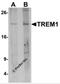 Triggering Receptor Expressed On Myeloid Cells 1 antibody, 7185, ProSci Inc, Western Blot image 