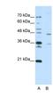 Zinc Finger Protein 488 antibody, NBP1-80422, Novus Biologicals, Western Blot image 