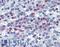 Arachidonate 5-Lipoxygenase antibody, LS-C141578, Lifespan Biosciences, Immunohistochemistry frozen image 