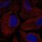 Transmembrane Protein 198 antibody, PA5-65330, Invitrogen Antibodies, Immunofluorescence image 