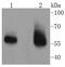Interleukin 1 Receptor Associated Kinase 3 antibody, NBP2-67647, Novus Biologicals, Western Blot image 