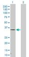 Hydroxysteroid 17-Beta Dehydrogenase 7 antibody, H00051478-D01P, Novus Biologicals, Western Blot image 