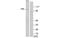 Progesterone Receptor antibody, MBS838933, MyBioSource, Western Blot image 