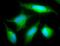 RAB5A, Member RAS Oncogene Family antibody, NB120-13253, Novus Biologicals, Immunocytochemistry image 