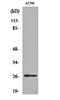 Cyclin Dependent Kinase Inhibitor 1B antibody, orb159598, Biorbyt, Western Blot image 