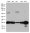 O-6-Methylguanine-DNA Methyltransferase antibody, LS-C800058, Lifespan Biosciences, Western Blot image 
