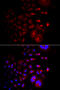 Trafficking Protein Particle Complex 10 antibody, MBS9126981, MyBioSource, Immunofluorescence image 