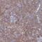 Transmembrane Protein 128 antibody, HPA044809, Atlas Antibodies, Immunohistochemistry paraffin image 