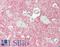 Solute Carrier Family 1 Member 3 antibody, LS-B13599, Lifespan Biosciences, Immunohistochemistry paraffin image 