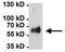 Heat Shock Protein Family D (Hsp60) Member 1 antibody, GTX25479, GeneTex, Immunoprecipitation image 