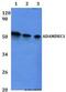 ADAM Like Decysin 1 antibody, LS-C412089, Lifespan Biosciences, Western Blot image 