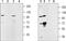 Transient Receptor Potential Cation Channel Subfamily M Member 5 antibody, PA5-77325, Invitrogen Antibodies, Western Blot image 