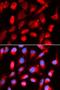 Uroporphyrinogen Decarboxylase antibody, LS-C334092, Lifespan Biosciences, Immunofluorescence image 