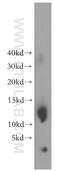 Splicing Factor 3b Subunit 5 antibody, 15525-1-AP, Proteintech Group, Western Blot image 