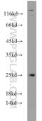Centrosomal Protein 70 antibody, 16280-1-AP, Proteintech Group, Western Blot image 