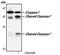 Caspase 7 antibody, MA5-15159, Invitrogen Antibodies, Western Blot image 