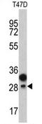 Protein C Receptor antibody, AP17203PU-N, Origene, Western Blot image 