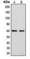 Cytochrome P450 Family 4 Subfamily F Member 2 antibody, orb214800, Biorbyt, Western Blot image 