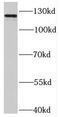 SLIK3 antibody, FNab07982, FineTest, Western Blot image 