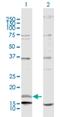 Neuregulin 4 antibody, H00145957-D01P, Novus Biologicals, Western Blot image 