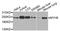 Myosin Heavy Chain 9 antibody, A0173, ABclonal Technology, Western Blot image 