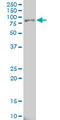 Arachidonate 15-Lipoxygenase antibody, LS-B4278, Lifespan Biosciences, Western Blot image 