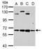 Chaperonin Containing TCP1 Subunit 8 Like 2 antibody, PA5-34863, Invitrogen Antibodies, Western Blot image 