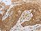 Creatine Kinase, M-Type antibody, CSB-PA561050, Cusabio, Immunohistochemistry paraffin image 