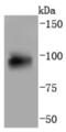 Aryl Hydrocarbon Receptor antibody, NBP2-67125, Novus Biologicals, Western Blot image 