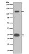 Poly(ADP-Ribose) Polymerase 1 antibody, M00122-3, Boster Biological Technology, Western Blot image 