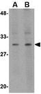 RASD Family Member 2 antibody, GTX85428, GeneTex, Western Blot image 