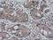 Mitogen-Activated Protein Kinase Kinase 3 antibody, LS-C174559, Lifespan Biosciences, Immunohistochemistry frozen image 