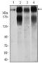 Integrin Subunit Beta 4 antibody, MA5-17104, Invitrogen Antibodies, Western Blot image 